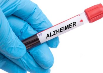 Pacienții suferinzi de boala Alzheimer se vor putea trata cu un nou medicament